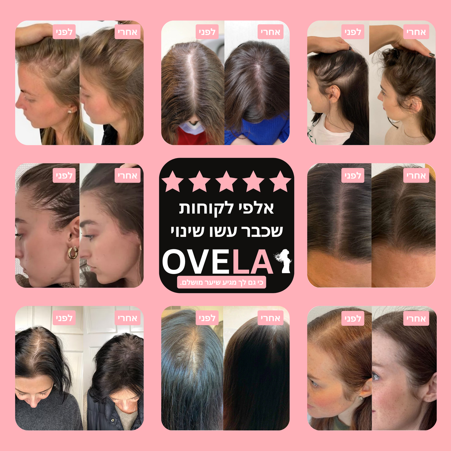 OvelaBrush™ - מסרק חכם לשיקום הקרקפת